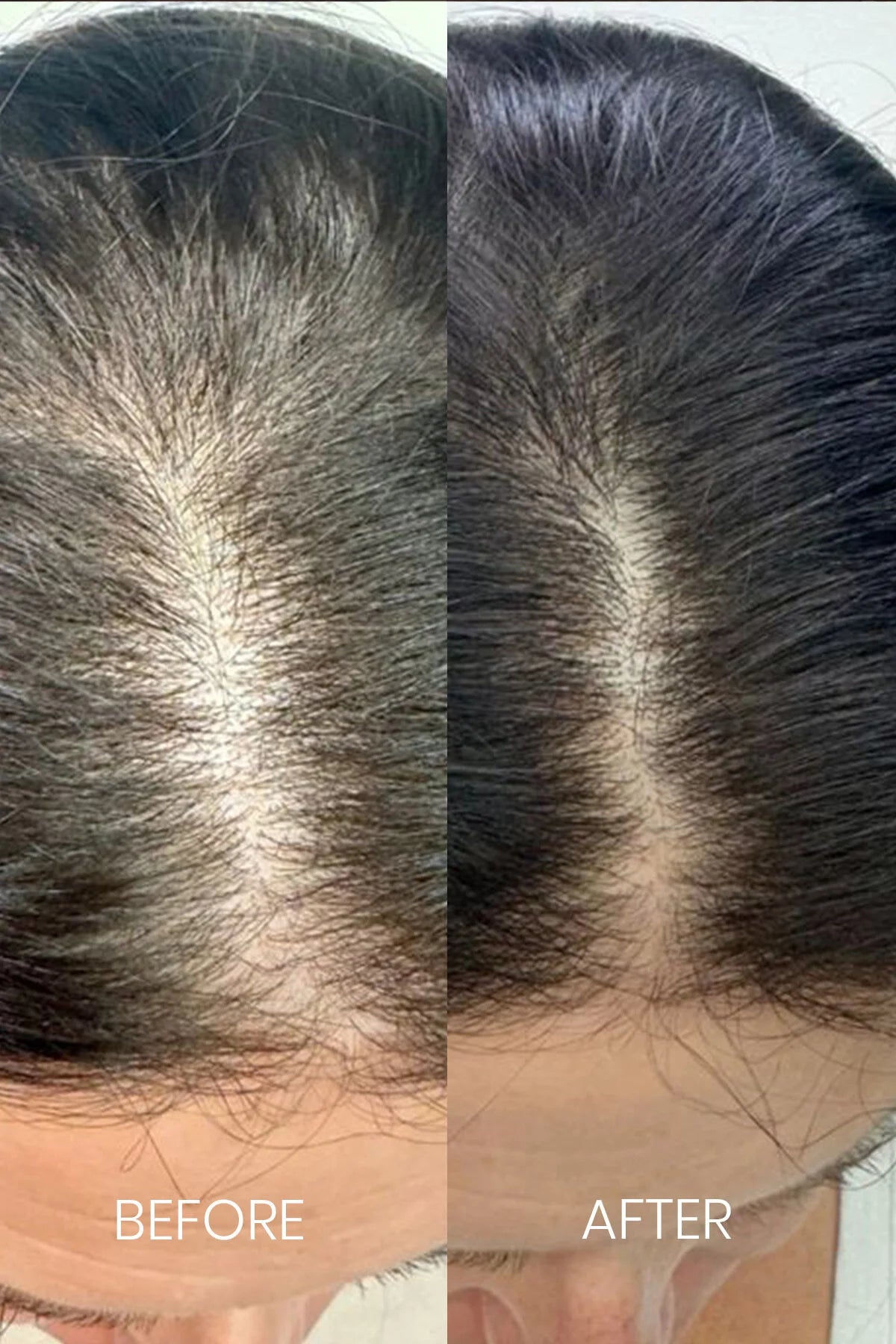 Luis Bien Kara Sarımsak Saç Bakım Yağı 50 ml – Onarıcı
