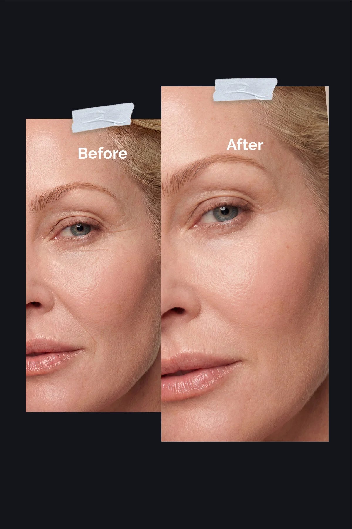 Jeuvenile Kırışıklık Karşıtı Anti-Aging Bakım Seti – Ton Eşitleyici