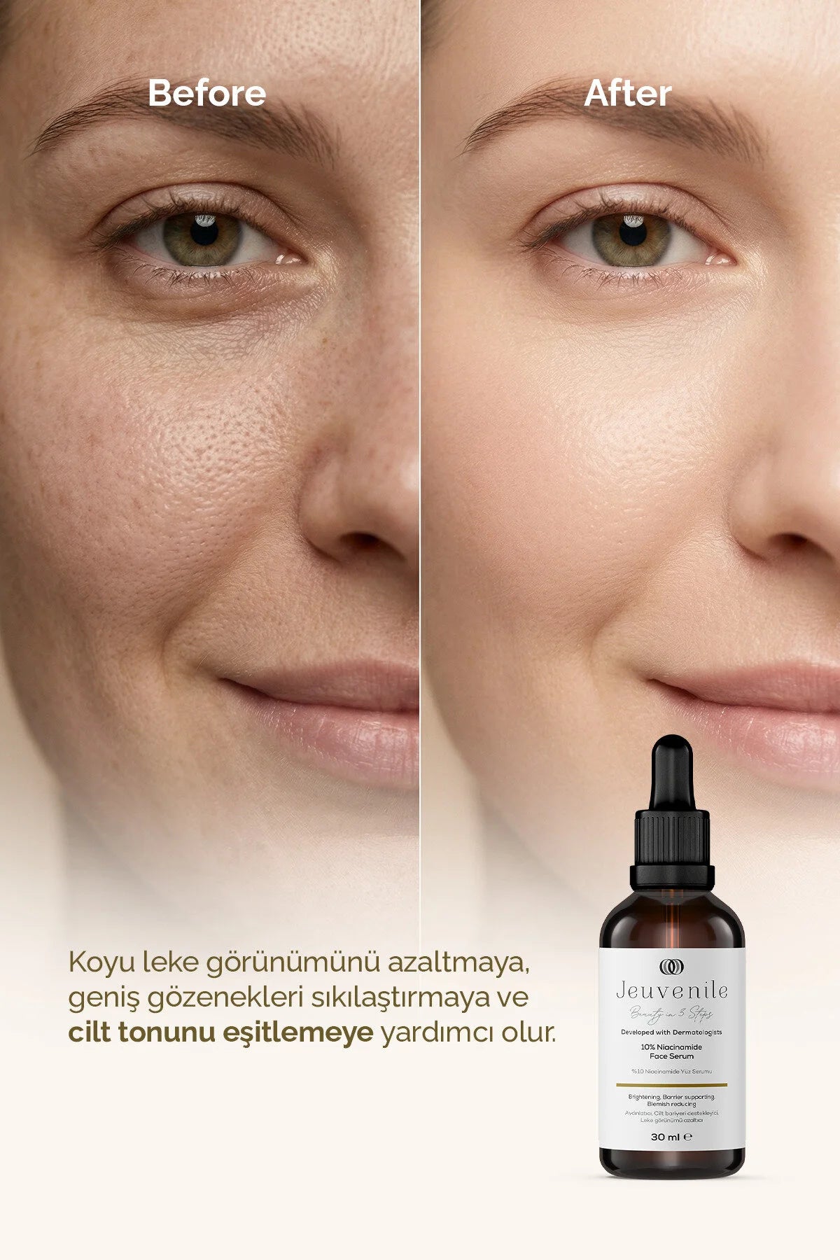 Jeuvenile Niacinamide Serum – Gözenek & Ton Eşitleyici Bakım