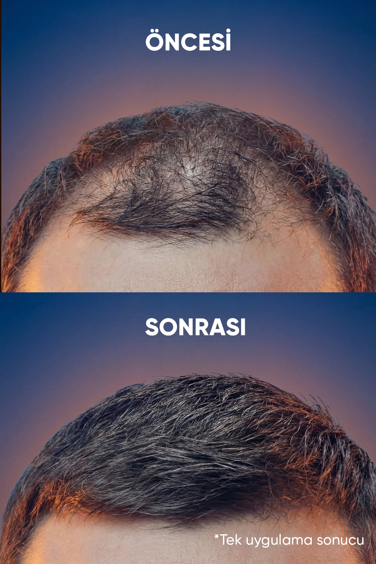 Luis Bien Saç Dolgunlaştırıcı Sprey - Siyah