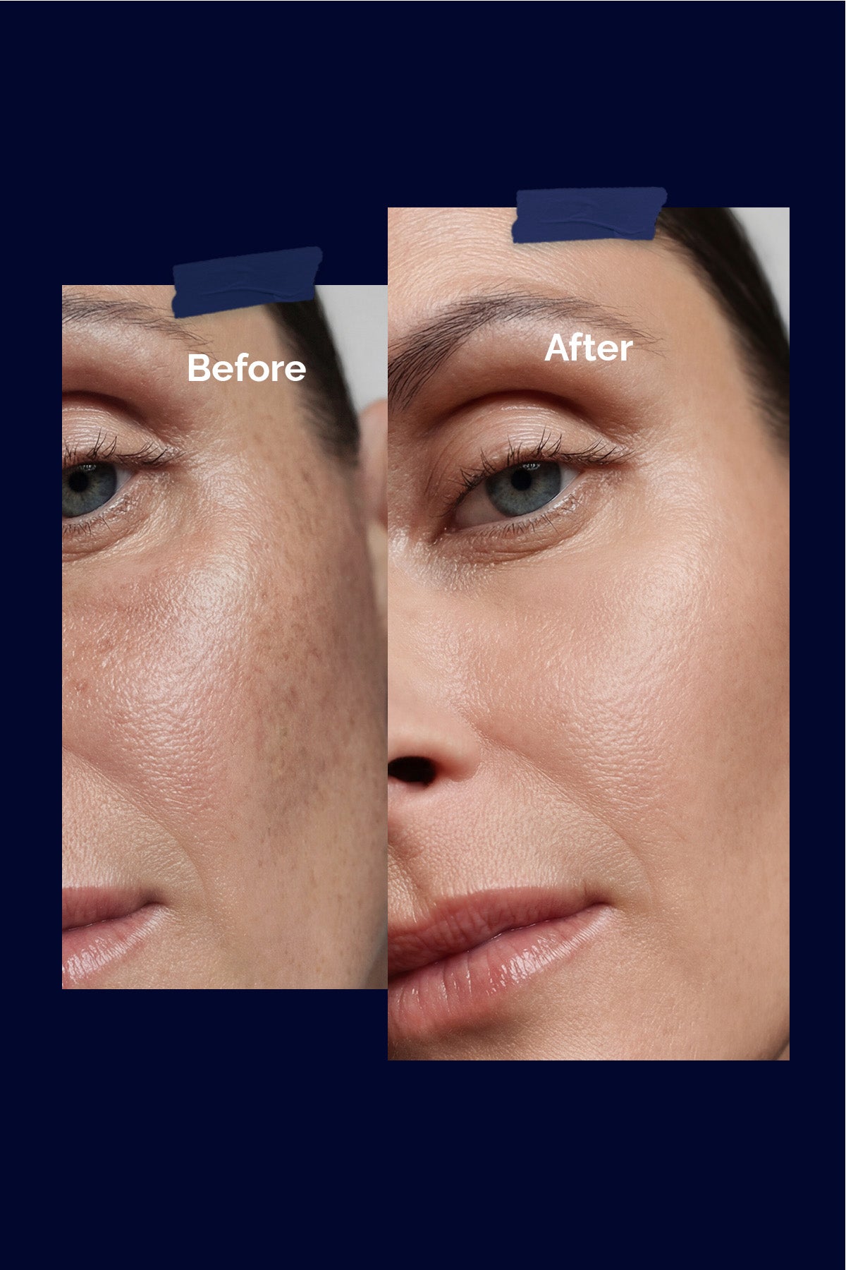 Anti Blemish Aydinlatici Daha Esit Yüz Kremi – Ton Eşitleyici | Vibee