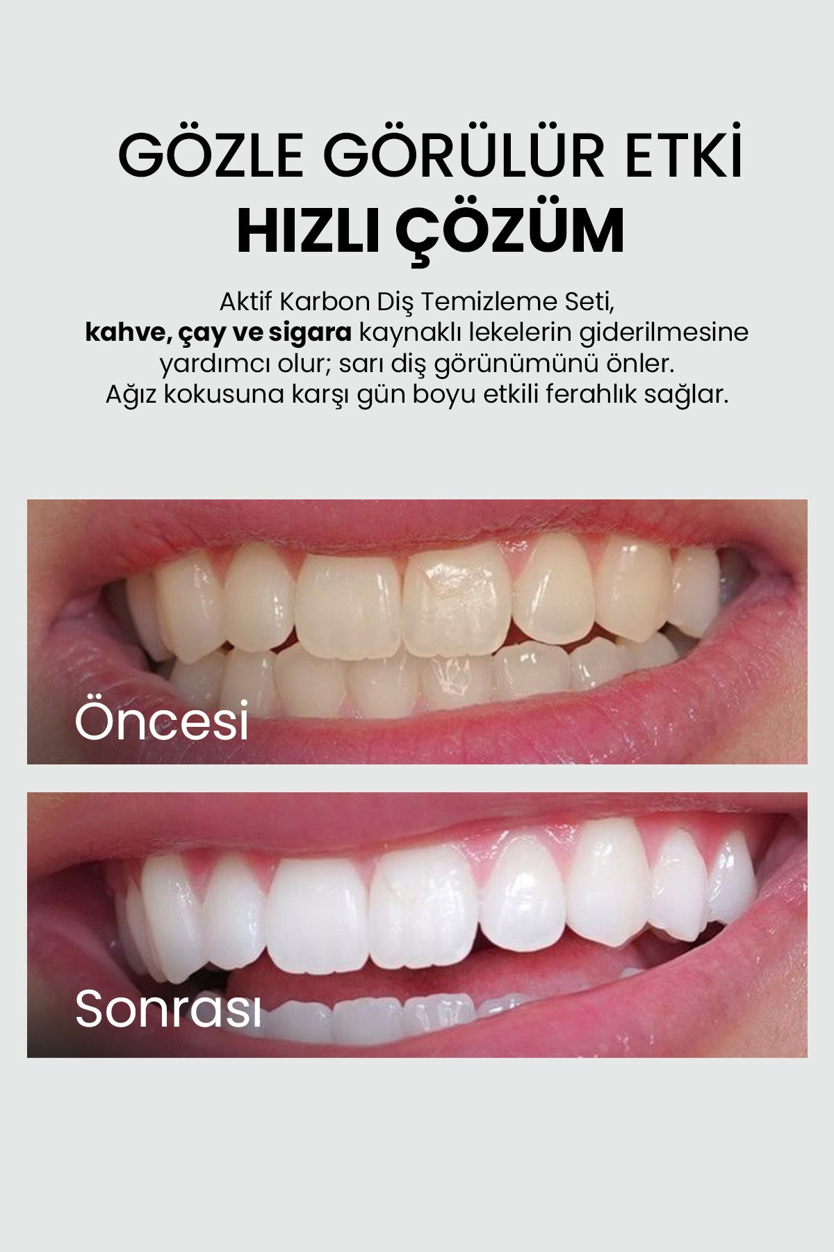 Diş Beyazlatma Tozu - Aktif Karbon 50 g | Luis Bien