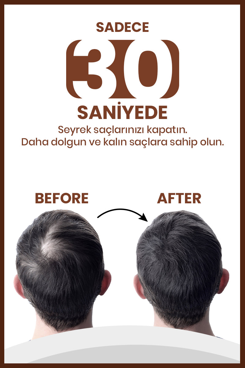 Luis Bien Saç Dolgunlaştırıcı Fiber Toz – Kahverengi