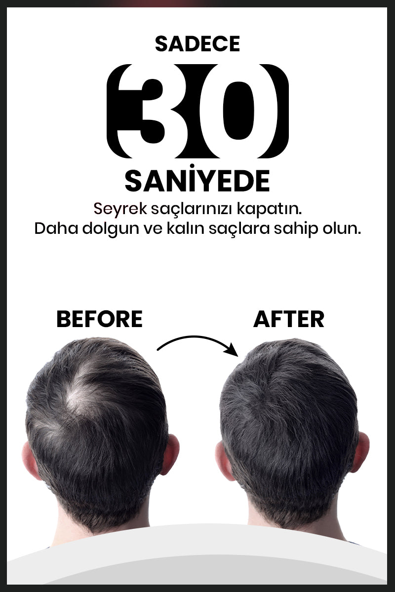Luis Bien Saç Dolgunlaştırıcı Fiber Toz – Siyah