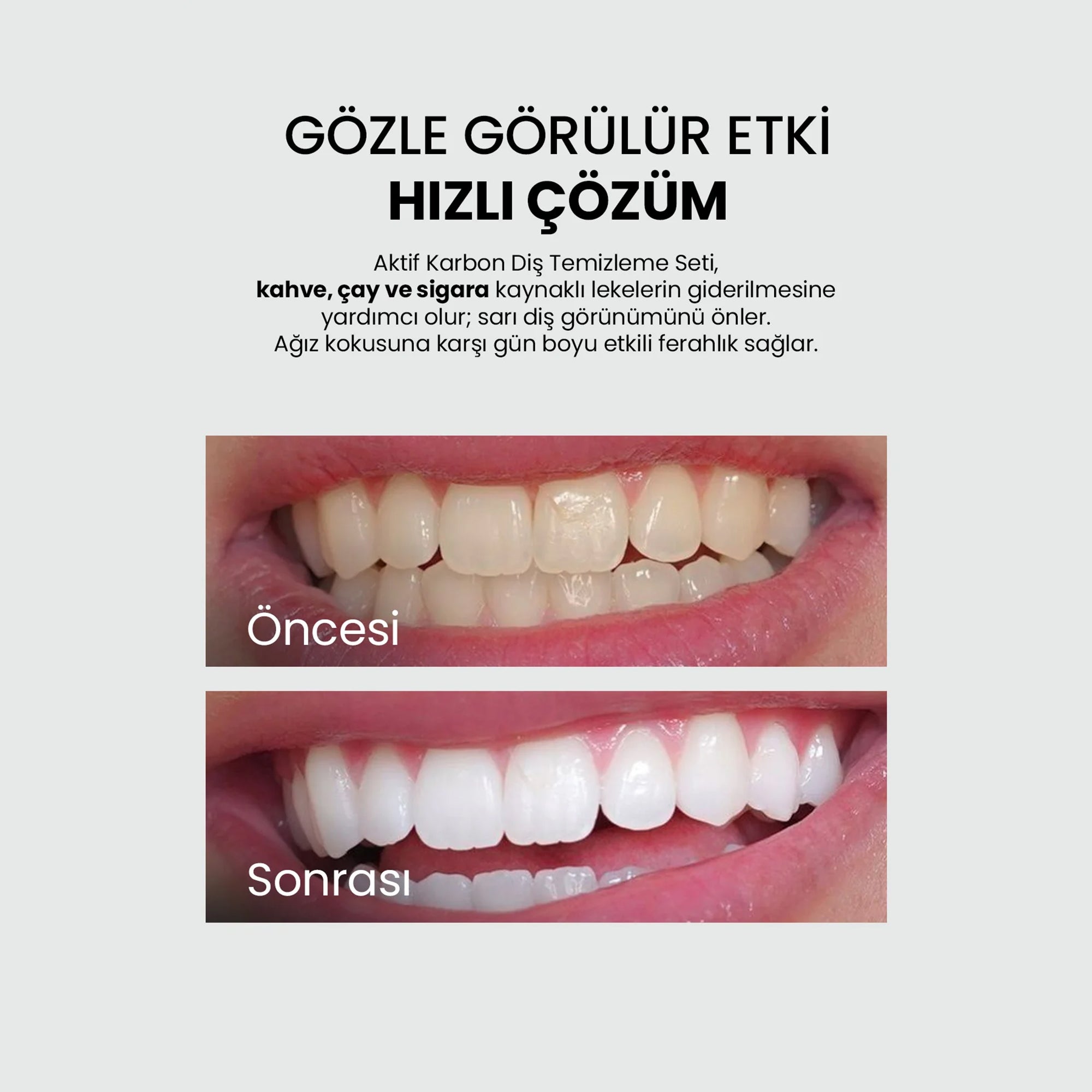 Beyazlatıcı Diş Macunu - Aktif Karbon Diş Macunu