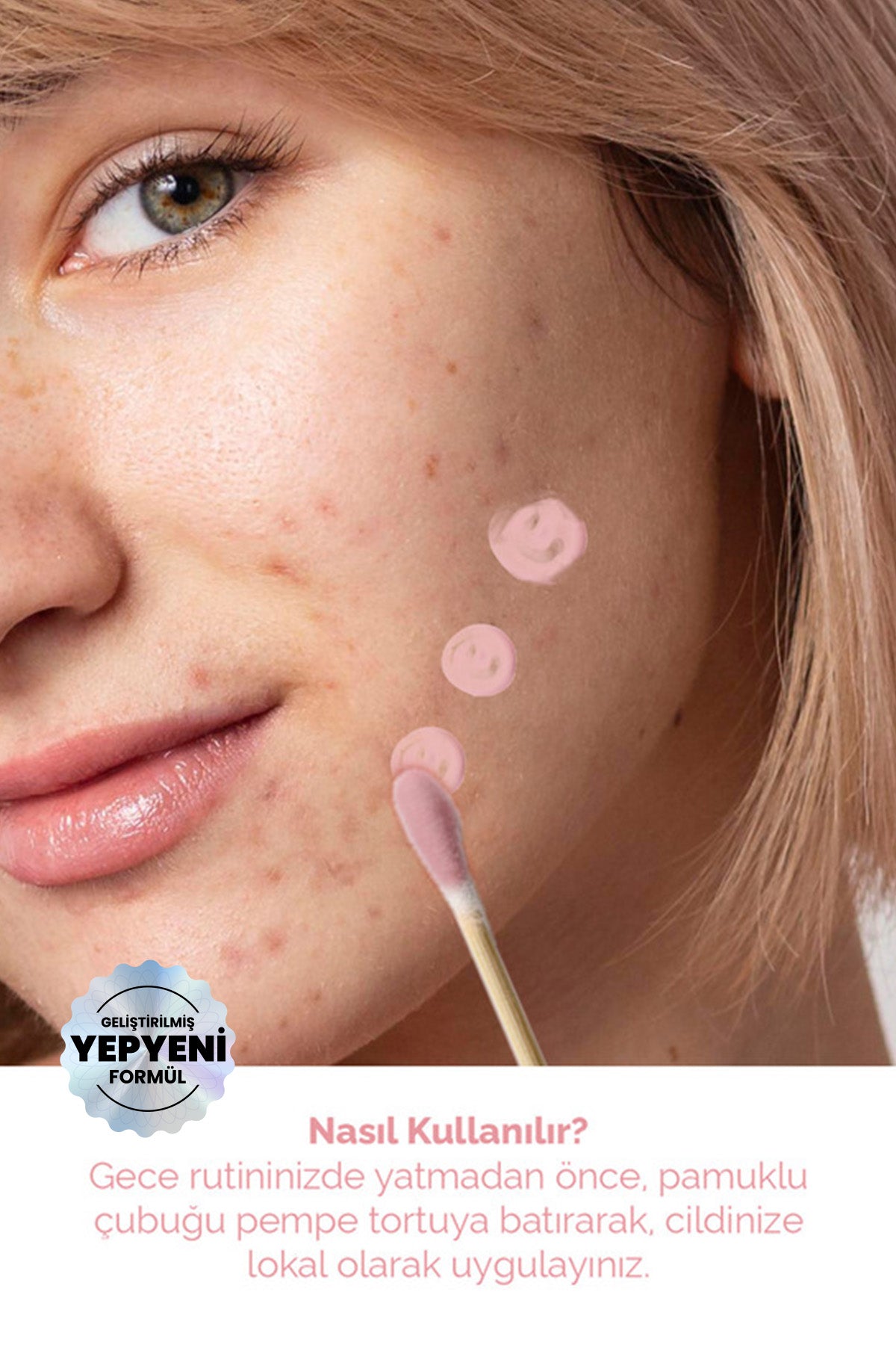 Akne Kurutucu Losyon