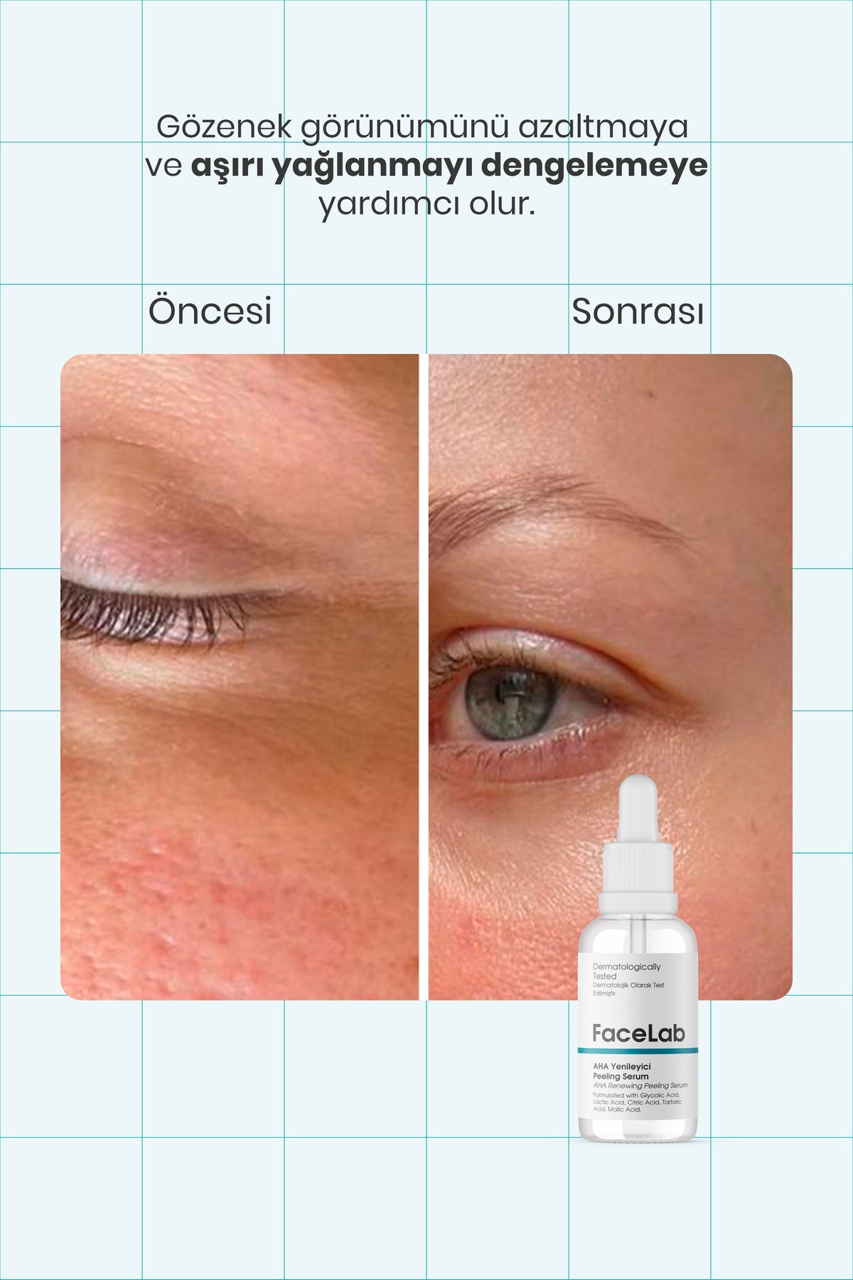 Facelab AHA Yenileyici Peeling Serumu