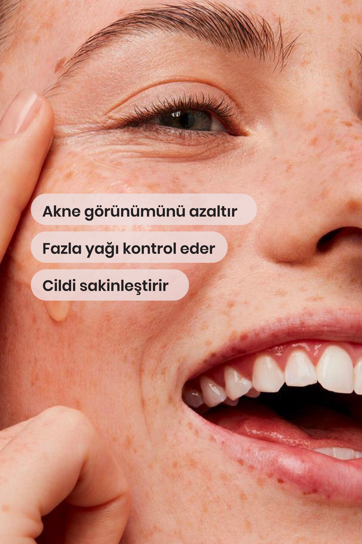 Akne Kurutucu Losyon - Salisilik Asit & Niasinamid | Facelab