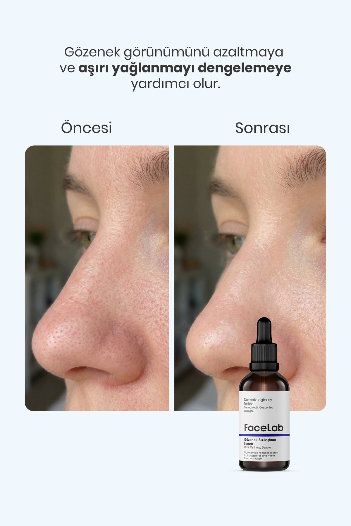 Facelab Gözenek Sıkılaştırıcı Yüz Serumu