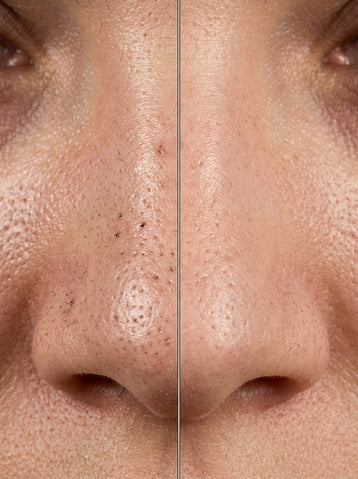 Jeuvenile Niacinamide İçerikli Arındırıcı Jel Yüz Temizleyici – Siyah Nokta Karşıtı